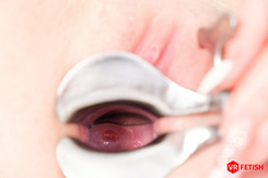 Czech VR Fetish 351 - Speculum in Action